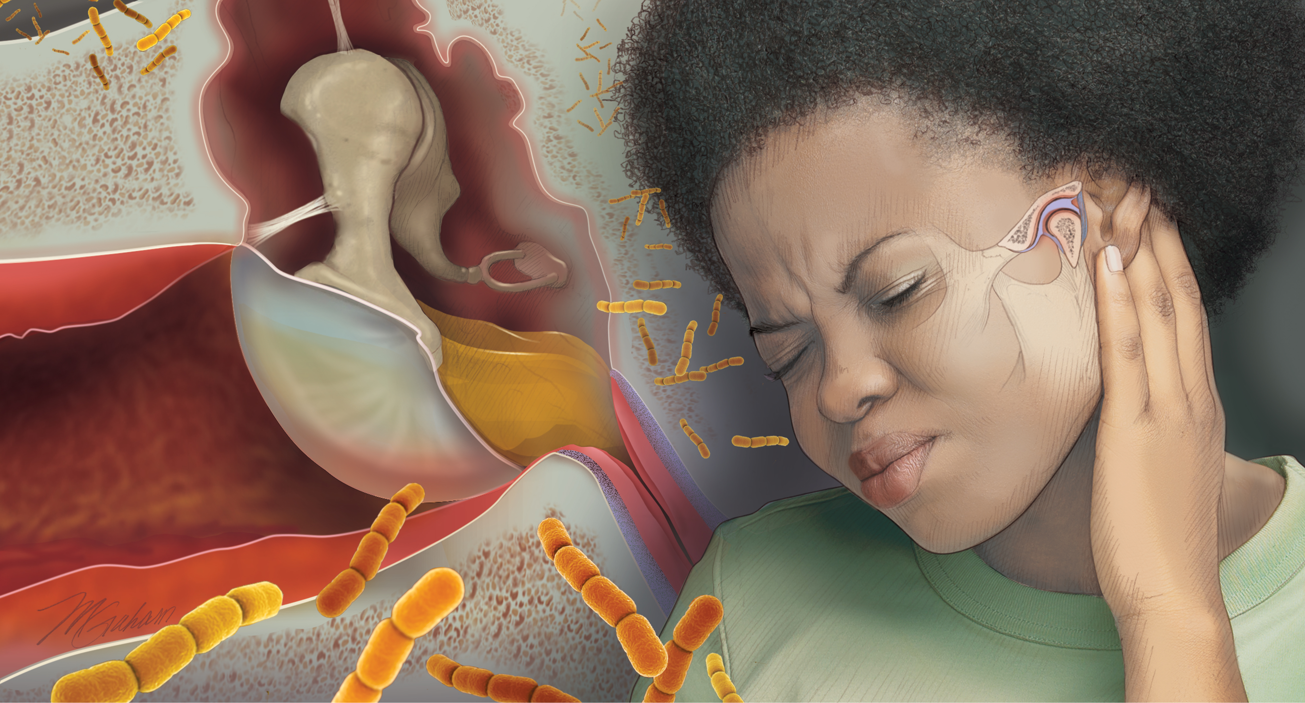 Woman with ear pain. Causes of pain can be otitis media, otitis external, upper respiratory infections, TMJ problems.